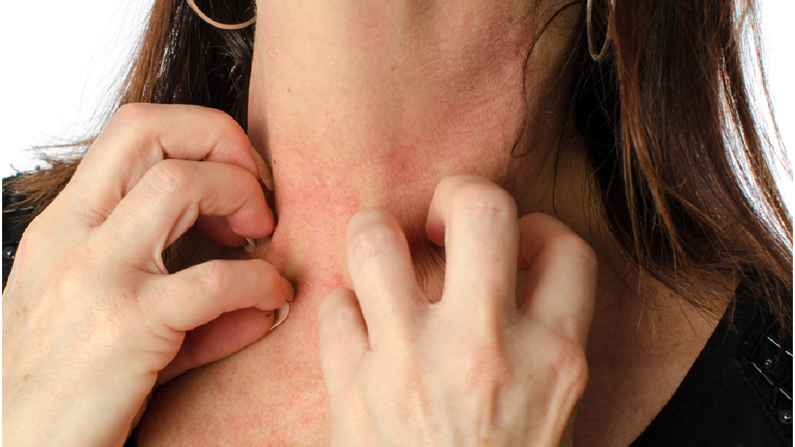Why are skin allergies more common in adults?