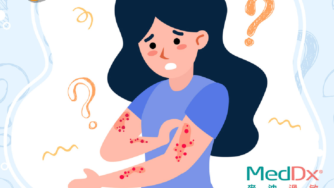 Guess what is “it” ? What actually causes urticaria?